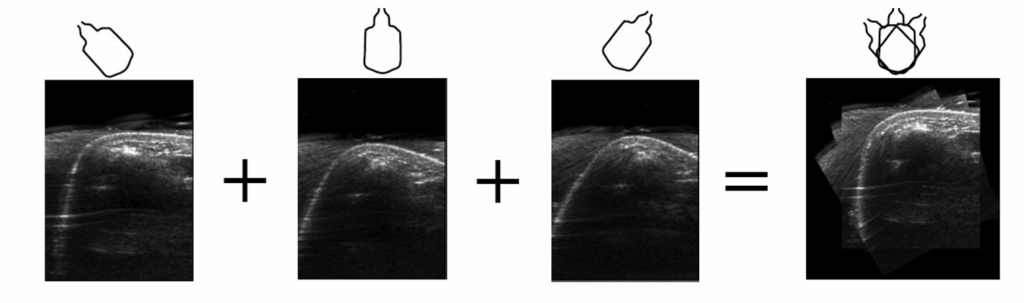 A table of results displaying the "Reconstructed Image of wrist" (top row) and the corresponding "Reconstructed Boundary of wrist" (bottom row) for four different human subjects, labeled Subject I through Subject IV.