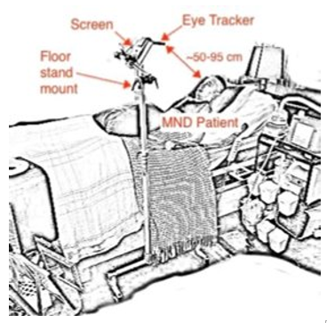 A diagram illustrating the clinical setup for the eye-gaze system. A patient with Motor Neurone Disease (MND) is lying in bed, using an eye-tracking device mounted on a floor stand to interact with a screen positioned above them.