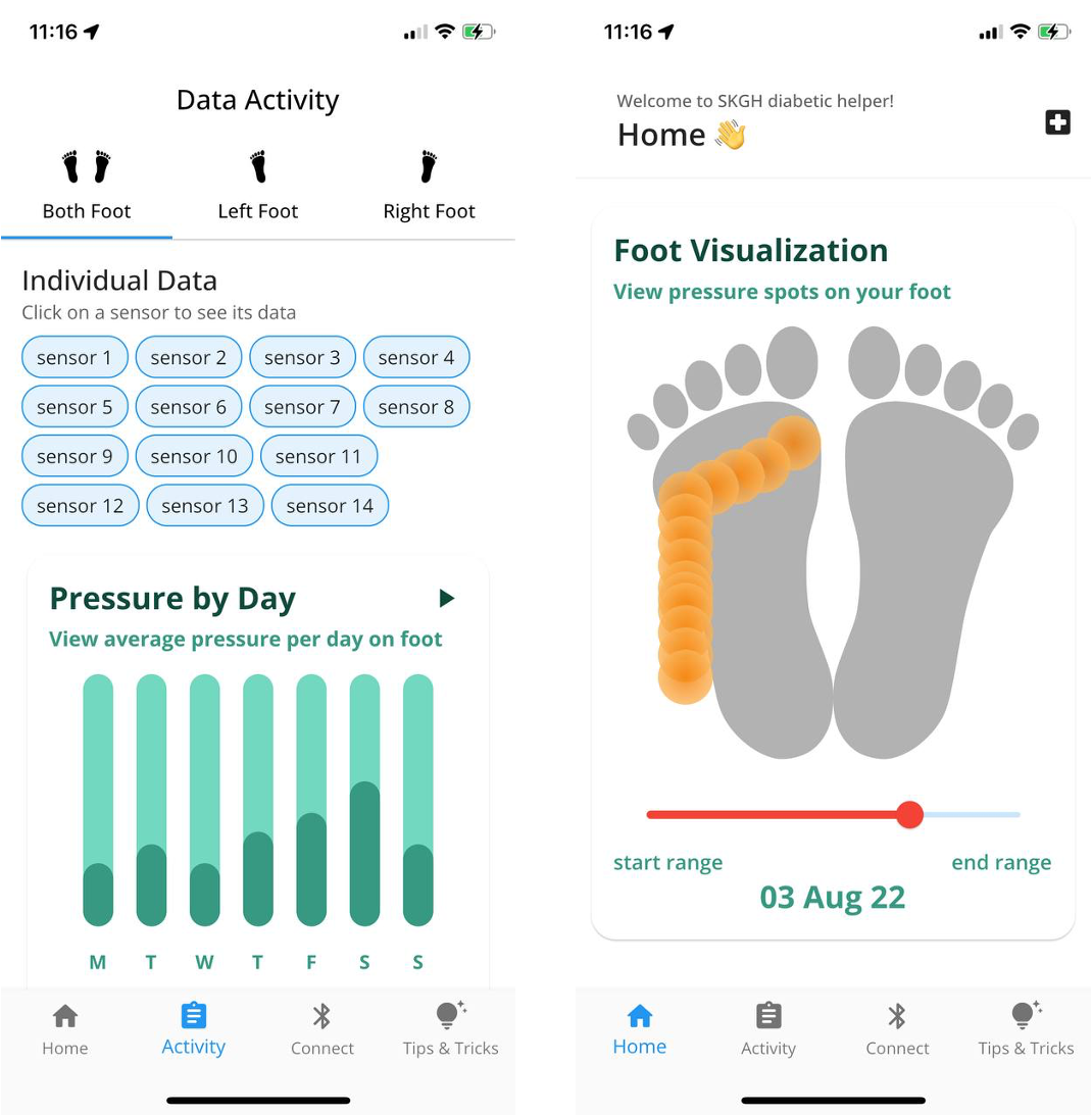 Two mobile app screenshots for a diabetic health-monitoring tool. The left screen shows "Data Activity" with individual sensor readings and a daily pressure bar chart. The right screen shows a "Foot Visualization" heat map displaying pressure spots on a foot.